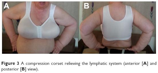 Professional Compression Bra Fitting - Cancer Rehabilitation & Lymphatic  Solutions