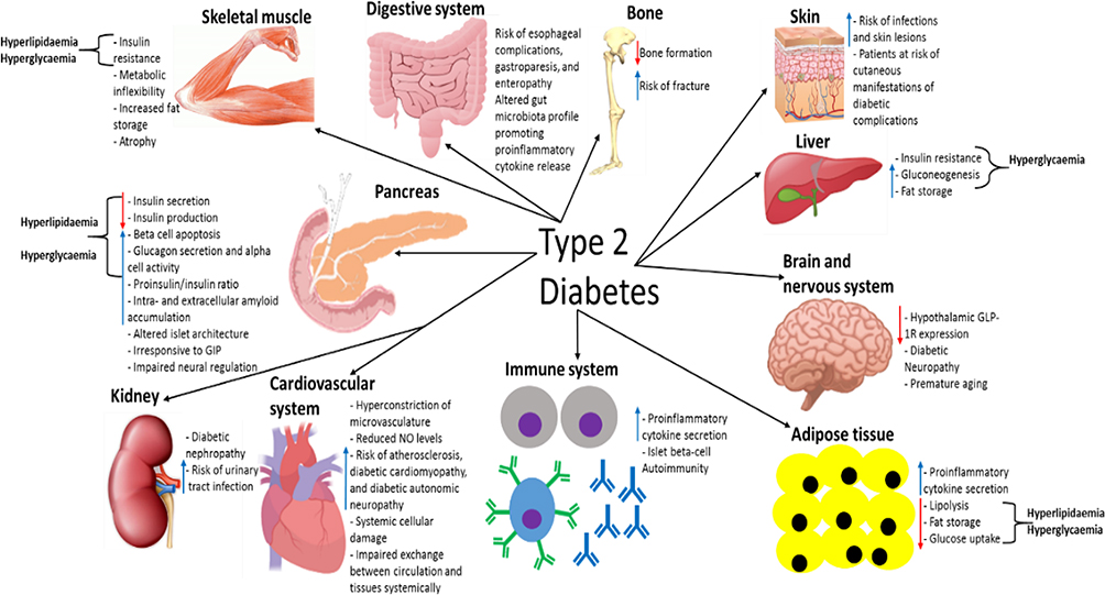 diabetes mellitus complications pathophysiology