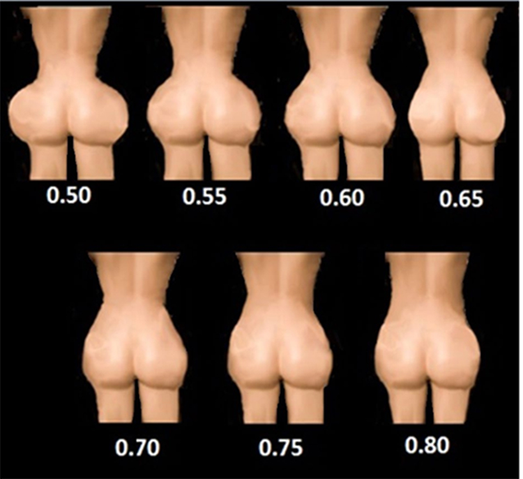 Mendieta points diagram. Used in the body contouring procedure, by